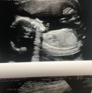 Meet your Posher, Jake